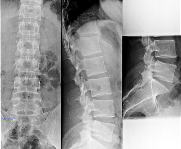 Radiographie numérisée et radiographie dentaire