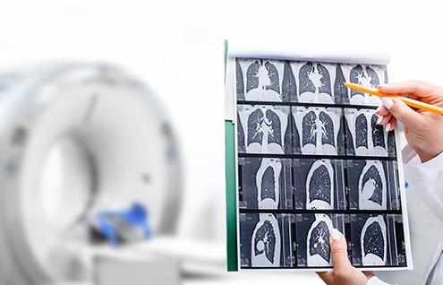 Scanner thoracique